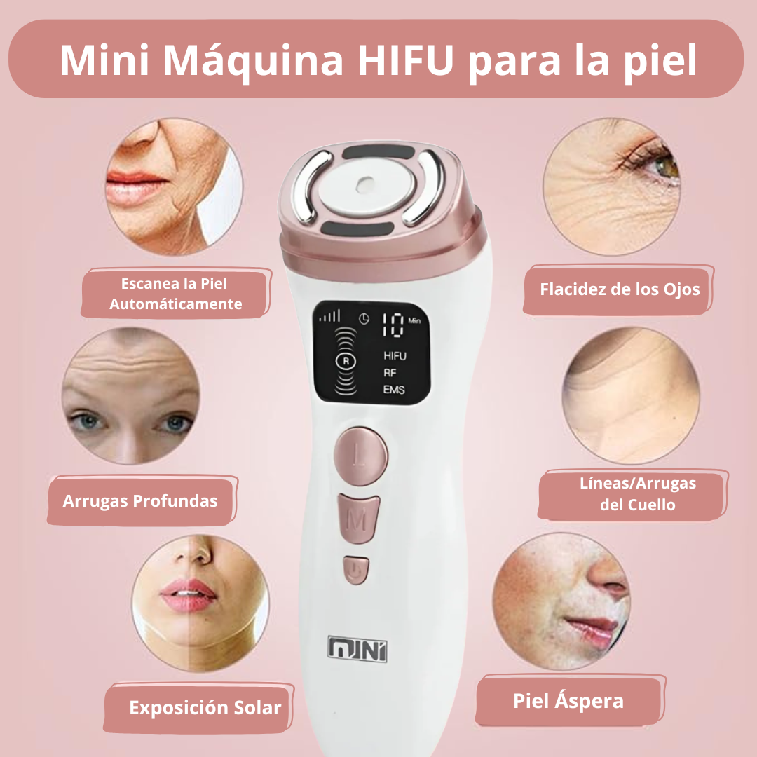 Máquina facial ultrasónica HiFU RF para reafirmar la piel